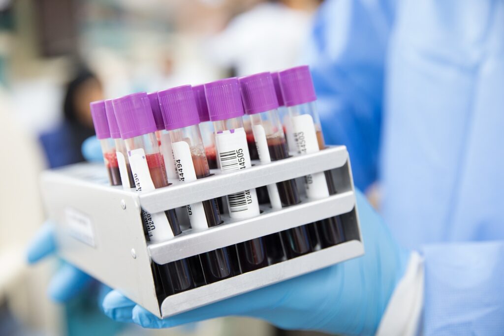 Reducing Racial Disparities in Early Cancer Diagnosis With Blood-Based  Tests – USC Schaeffer